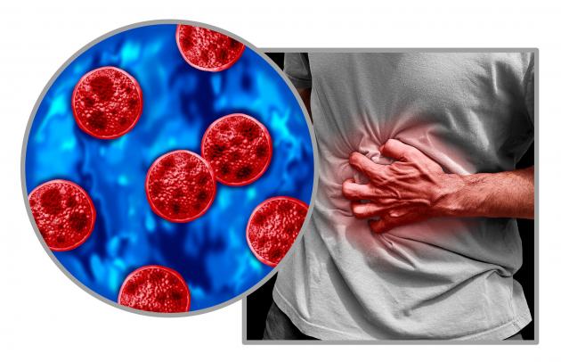 Cyclospora cases rise as doctor shares prevention tips